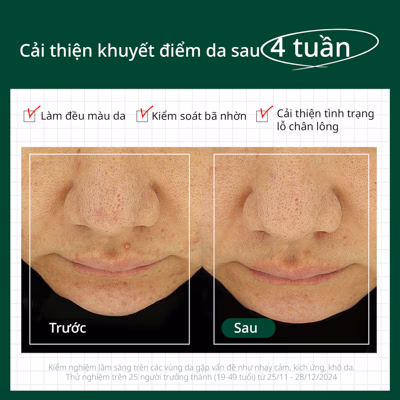 Serum cấp ẩm và làm dịu Dr.G R.E.D Blemish Hyal Cica Soothing Serum 50ml